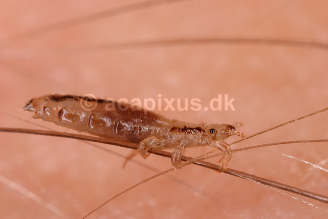 Hovedlus. Hoved lus; Pediculus humanus capitis; ; ; ; insekter; Egentlige lus, Siphunculata, ut�j, skadedyr, h�r, hovedbund, plettyfus