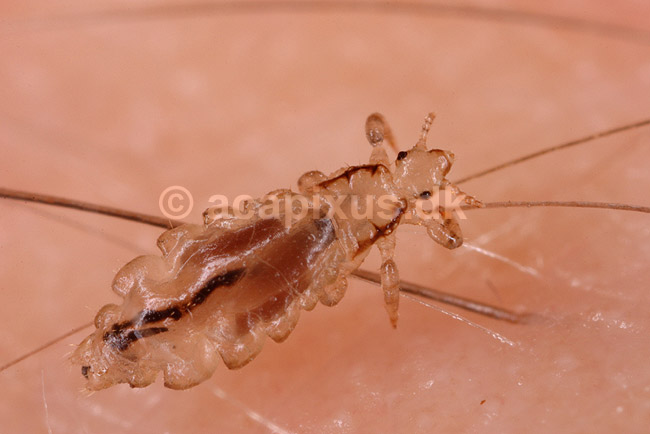 Hovedlus. Hoved lus; Pediculus humanus capitis; ; ; ; insekter; Egentlige lus, Siphunculata, ut�j, skadedyr, h�r, hovedbund, plettyfus