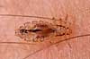 Hovedlus. Hoved lus Pediculus humanus capitis    insekter Egentlige lus, Siphunculata, ut�j, skadedyr, h�r, hovedbund, plettyfus